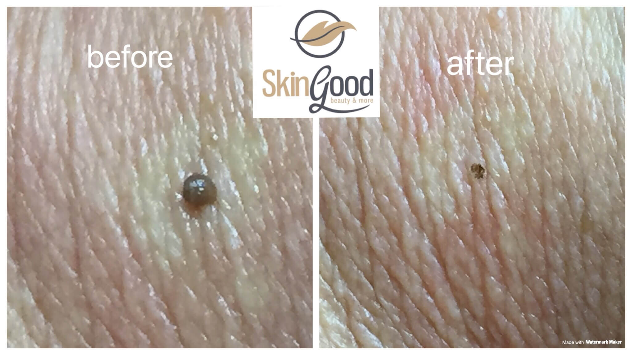 SkinGood Huidoneffenheden